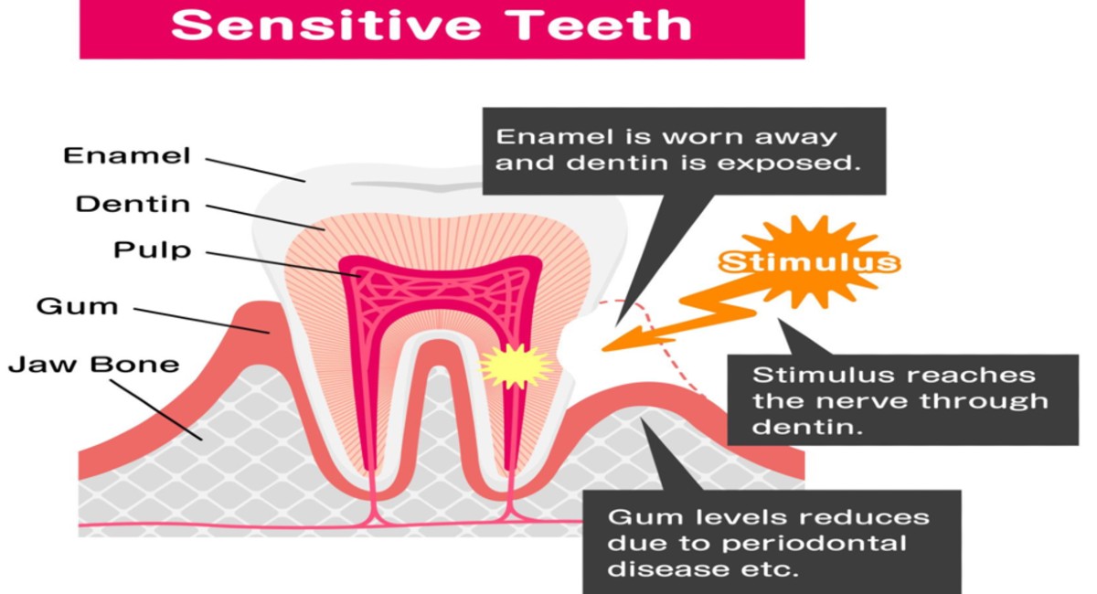 Why Do Teeth Become Sensitive? Causes and Treatment