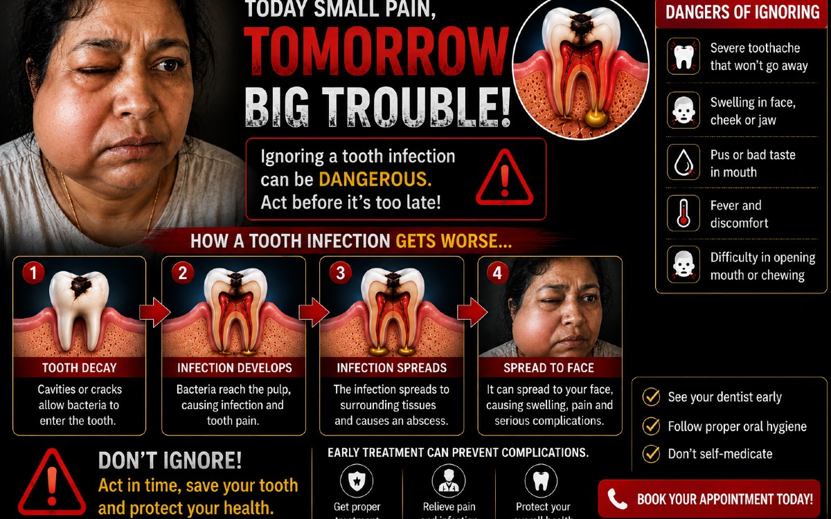Can a Tooth Infection Spread to Your Face? Warning Signs You Should Never Ignore